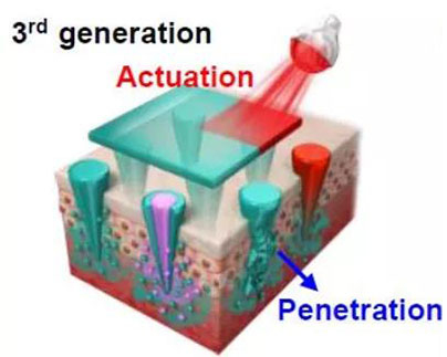 第三代：通过微针介导的皮肤层破坏和微针伴随的各种功能增强药物转运.jpg