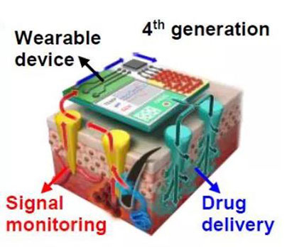 第四代透皮给药技术：在可穿戴设备的帮助下，用于患者定制治疗.jpg