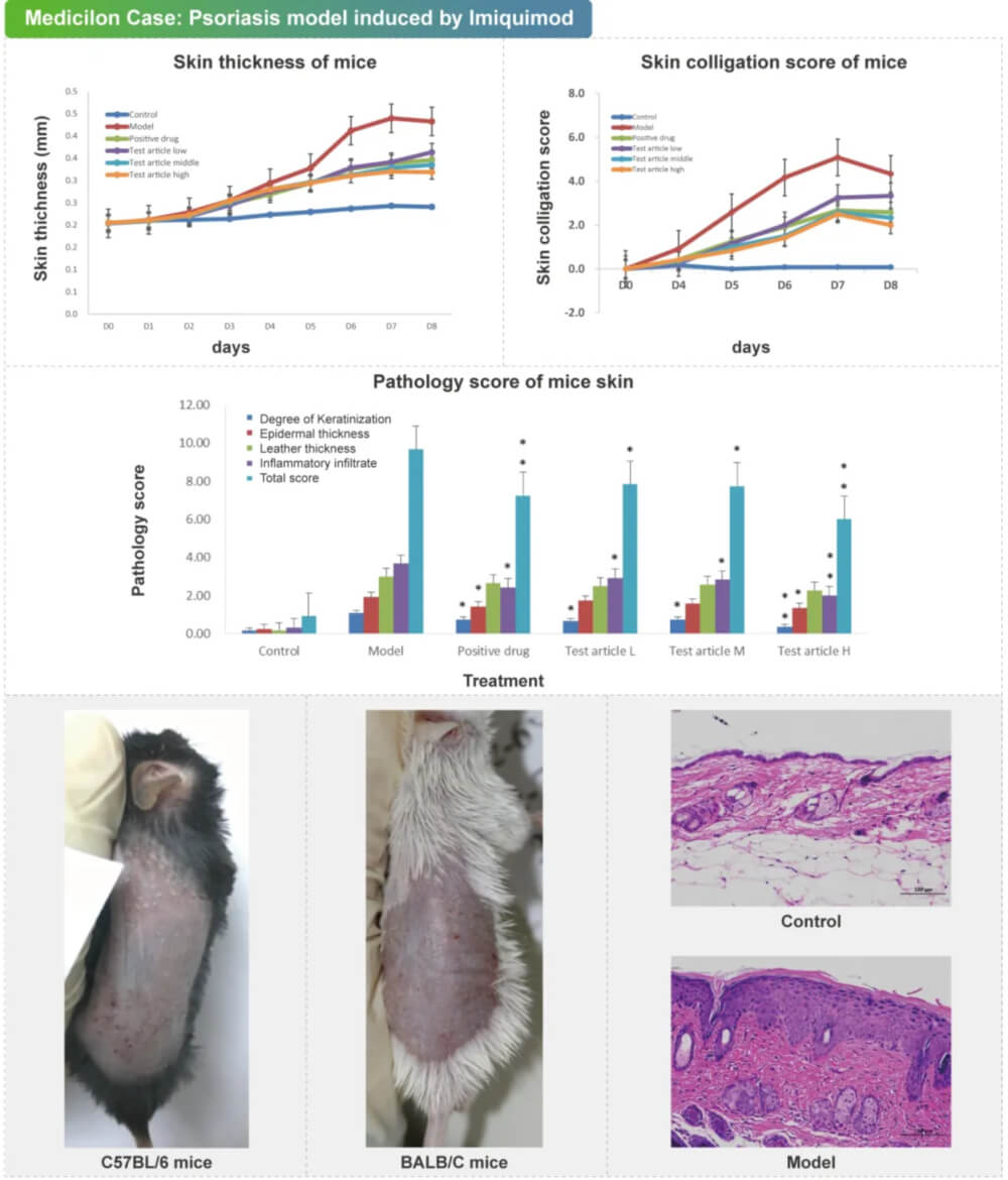 05 咪喹莫特诱导的银屑病模型.jpg